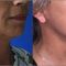Lifting du visage