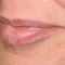 Filler