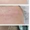 Antiaging