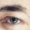 Eyelid surgery (Blepharoplasty)
