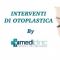 Otoplastica mini invasiva