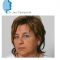 Lipofilling ou autogreffe de tissu graisseux
