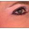 Nichtchirurgische Faltenbehandlung - BOTOX® / DYSPORT®