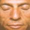 Sculptra