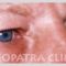 Operace očních víček (Blefaroplastika)