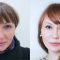 Liquid facelift