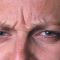 BOTOX®