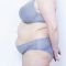 Abdominoplastika (Operace břicha)