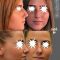 Operácia nosa (Rhinoplastika)