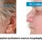 Regeneris – biostimulation of skin cells