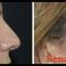 Injections d