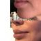 Lifting facial par fils tenseurs - PDO