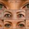 Operácia očných viečok (Blepharoplastika)