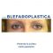 Blefaroplastica