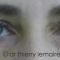 Blépharoplastie