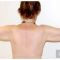 Lifting des bras