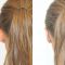 Ear surgery (Otoplasty)