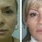 Antiaging