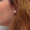 Rhinoplastie