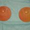 Austausch eines Implantats