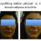 Ingrandimento labbra con grasso (lipofilling)