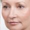 Sculptra