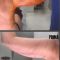 Lifting delle braccia